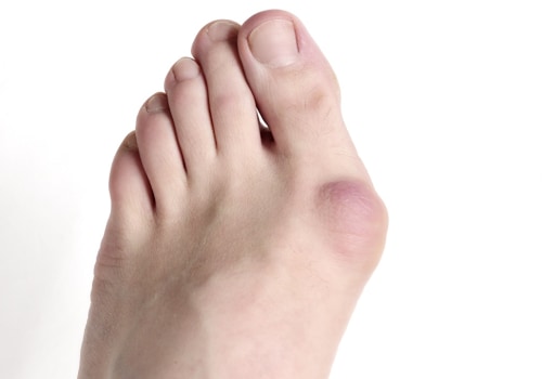 Understanding Foot Pain: When to Seek Medical Attention