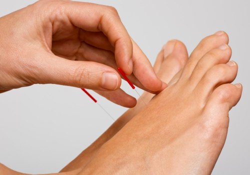 Expert Tips for Relieving Foot Pain