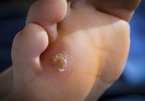 The Most Common Foot Injuries and How to Prevent Them